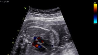 Imagem da Publicação Ecocardiografia Fetal
